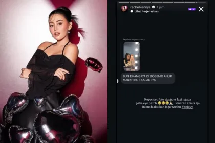 Rachel Vennya Klarifikasi Mata Lebam, Bukan Ditonjok Okin?