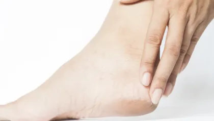 Dari Komedo sampai Tumit Pecah, Ini Kandungan Skincare yang Cocok Atasi Masalah Kulit