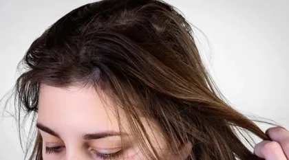 7 Trik Ampuh Atasi Rambut Lepek Meski Baru Keramas, Nomor 3 Sering Banget Diabaikan!