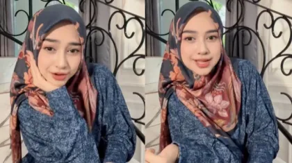 Ria Ricis Buka Suara, Akui Jalani Operasi Hidung Usai Tampil Beda Drastis