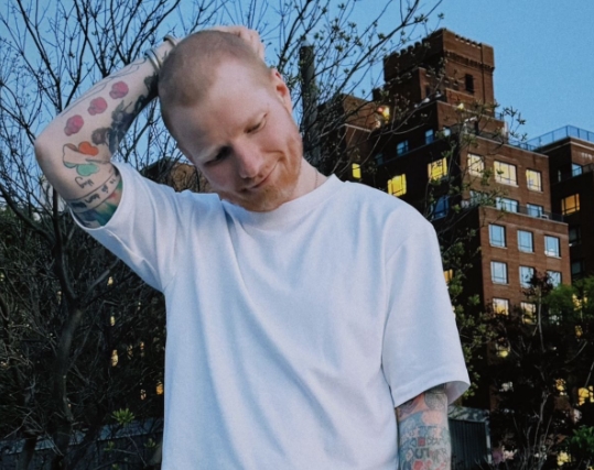 Ed Sheeran Mendadak Botak! Ternyata Sempat Terserang Herpes Zoster Selama Sebulan