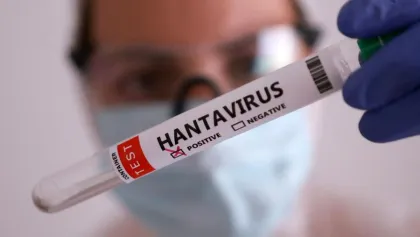 Hantavirus Jadi Perhatian Dunia, Begini Cara Penularannya ke Manusia