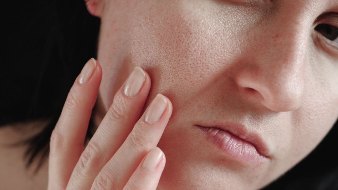 7 Skincare untuk Kulit Bertekstur, Dari Toner Eksfoliasi sampai Serum