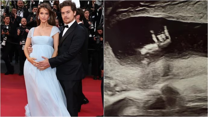 Belajar dari Barbara Palvin, Begini Cara Meningkatkan Peluang Hamil Meski Mengalami Endometriosis
