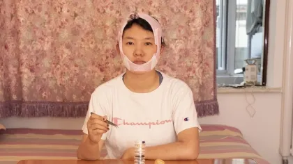 Operasi Plastik Jadi Senjata Bertahan Hidup Gen Z China: Cantik Bukan Pilihan, Tapi Kebutuhan!
