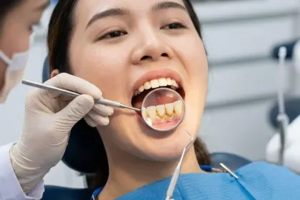 Fakta Karang Gigi pada Ibu Hamil, Benarkah Bisa Sebabkan Keguguran?