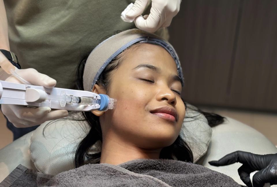 Teknologi Baru Skinbooster Tanpa Sakit, Remee Pro Jadi Andalan di Insta Beauty Center