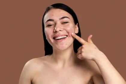 Jangan Salah Pilih, Ini Panduan Skincare yang Tepat untuk Kulit Sensitif, Berminyak, dan Berjerawat