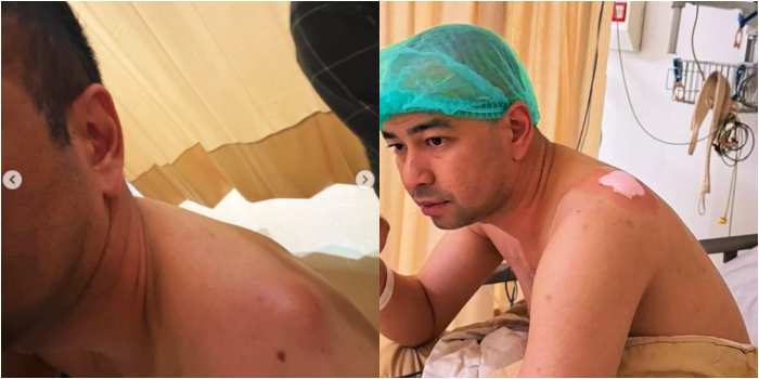 Raffi Ahmad Ungkap Kondisi ...