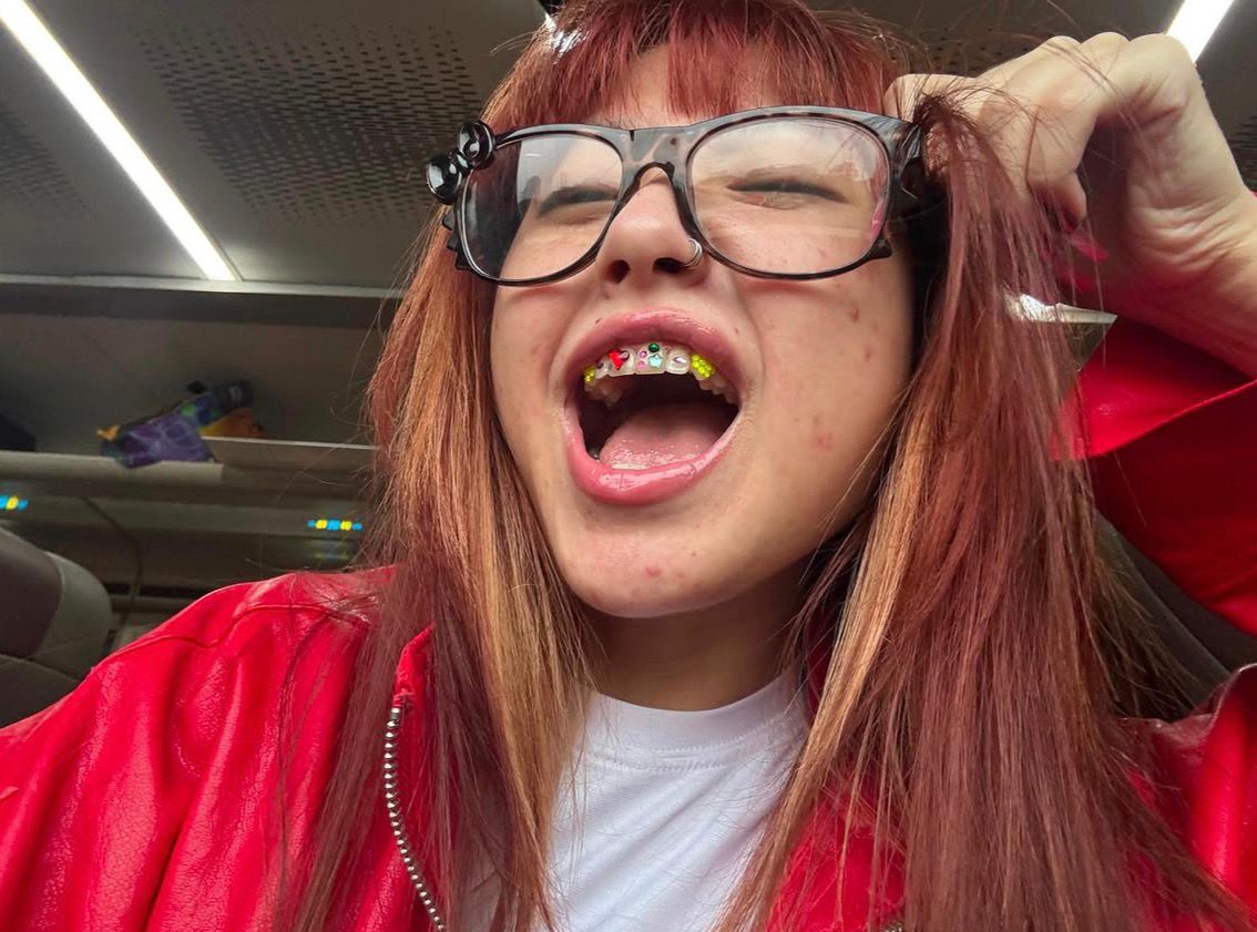 Mau Pasang Tooth Gem Sepert...