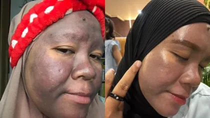 Sering Ganti Skincare karen...