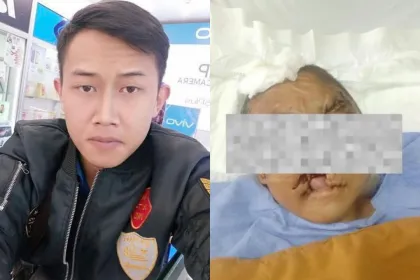 Sosok Taufik Hidayat Diburu! Terduga Pelaku Penyiksaan Sadis Wanita Bandung, Korban Alami Kebutaan hingga Bibir Terpotong