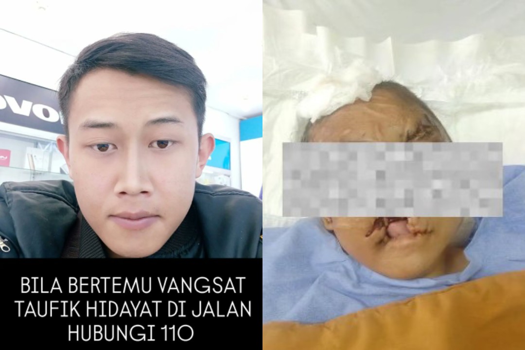 Ngeri Kasus Penyiksaan Sadis Wanita Bandung, Psikiater Bongkar 7 Ciri Psikopat yang Sering Tak Disadari