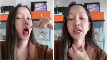 Wajib Tahu! Ini 8 Risiko Op...