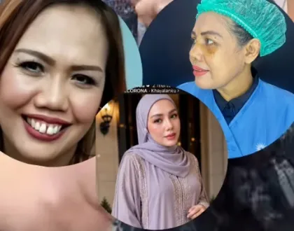 Elly Sugigi Termotivasi Benahi Gigi Usai Operasi Hidung, Akui Hinaan Netizen Jadi Penyemangat
