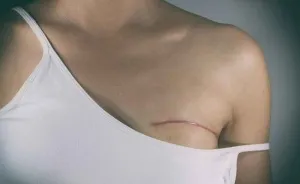 Hobi Cat Rambut Bisa Berujung Kanker Payudara hingga Risiko 60 Persen? Kenali Bahayanya