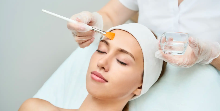 5 Hal yang Wajib Dilakukan Setelah Chemical Peeling agar Kulit Tidak Rusak