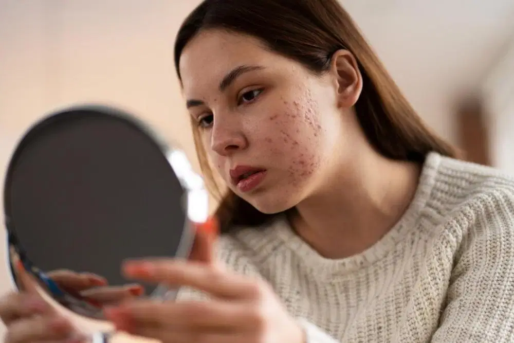 Kulit Gatal hingga Bengkak, Ini 6 Ciri Kulit Alergi terhadap Kandungan Skincare Tertentu!