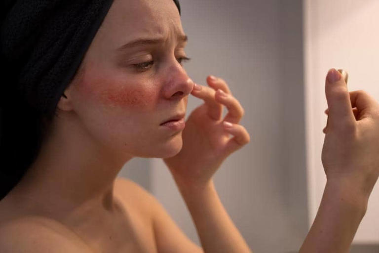Bikin Perih hingga Makin Jerawatan, Ini 7 Tanda Skincare Kamu Gak Cocok di Kulit