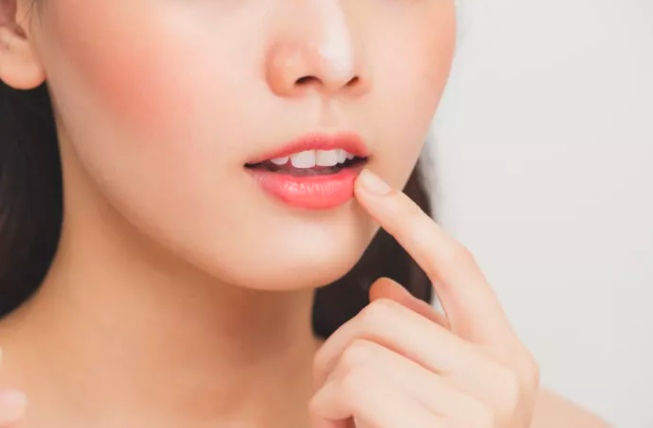 Stop Lakukan 5 Kebiasaan Ini Kalau Nggak Mau Bibir Kering dan Pecah-Pecah