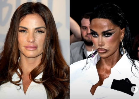 Dijuluki Ratu Operasi Plastik, Penampilan Influencer Katie Price Kini Jadi Sorotan