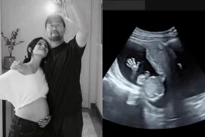 Lupakan Mindfulness! Maudy Ayunda Hamil Anak Pertama, Pamer Baby Bump dan Hasil USG Usai 7 Bulan